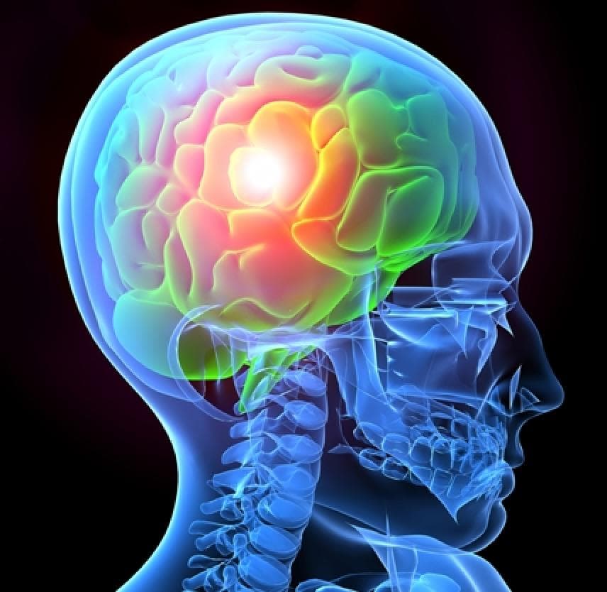 Image of a 3d head xtray. Accidents can happen at any time and result in life-altering injuries. Victims of brain and spine injuries face immense physical, emotional, and financial challenges. Finding the right attorney to handle such cases can be overwhelming. Dealing with a brain or spine injury is an uphill battle. The medical expenses, rehabilitation costs, and long-term care can drain your finances, leaving you feeling helpless. On top of that, navigating the legal complexities of personal injury law is a daunting task. R&G Personal Injury Lawyers are here to fight for you. Our team of experienced brain and spine injury attorneys understands the intricacies of these cases and is dedicated to seeking justice on your behalf. We will tirelessly advocate for maximum compensation, ensuring you receive the financial support needed for your recovery. With R&G Personal Injury Lawyers by your side, you can focus on healing while we handle the legal process. Our compassionate approach coupled with our extensive knowledge in this area of law will provide you with peace of mind knowing that you have a strong advocate fighting for your rights. Don't let the aftermath of a brain or spine injury consume your life. Contact R&G Personal Injury Lawyers today and let us help you get the justice and compensation you deserve.
