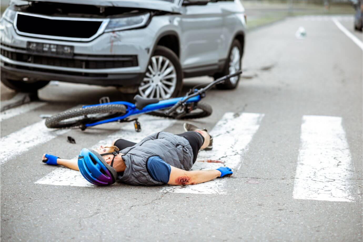Visual depiction of a man lying on the street, highlighting the expertise of R&G Personal Injury Lawyers in cases related to pedestrian accidents. The image aligns with the context of the page, emphasizing the firm's dedication to addressing such incidents.